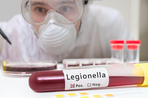 Sådan forebygger Rigshospitalet Glostrup legionella